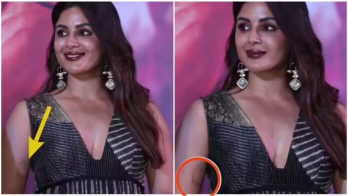 टीजर लॉन्च में सबकी नजरें संयुक्ता मेनन की बांह पर! ये निशान आखिर है क्या—एलर्जी या लव बाइट?