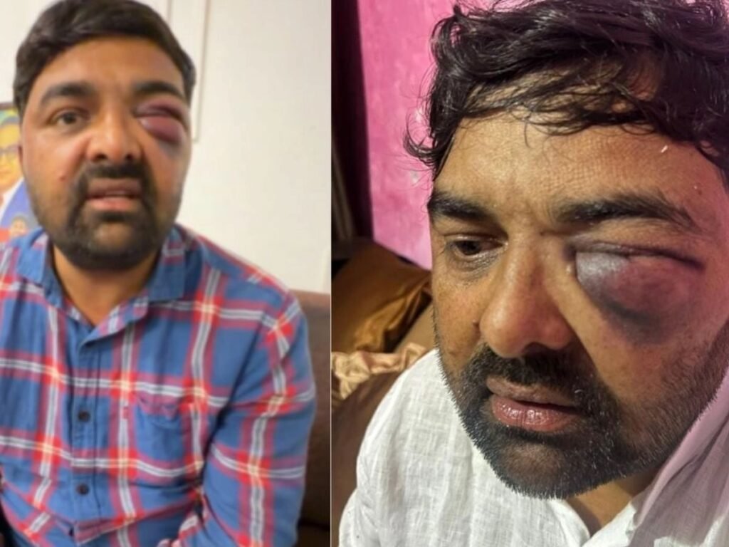 सपा नेता दिग्विजय भाटी, मोहित जाटव का आरोप- SSP अविनाश पांडे, अखिलेश गौड़ ने बर्बरता से पीटा