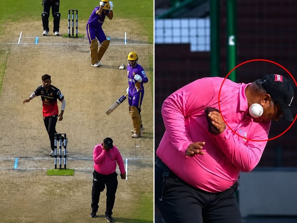Scary Scenes in DPL 2026: अंपायर ICU में भर्ती, मैच में दर्दनाक हादसा, सीधा चेहरे पर जा लगा जोरदार शॉट | Sports